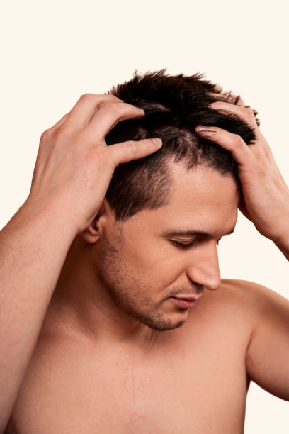 Greffe cheveux Médecine Esthétique