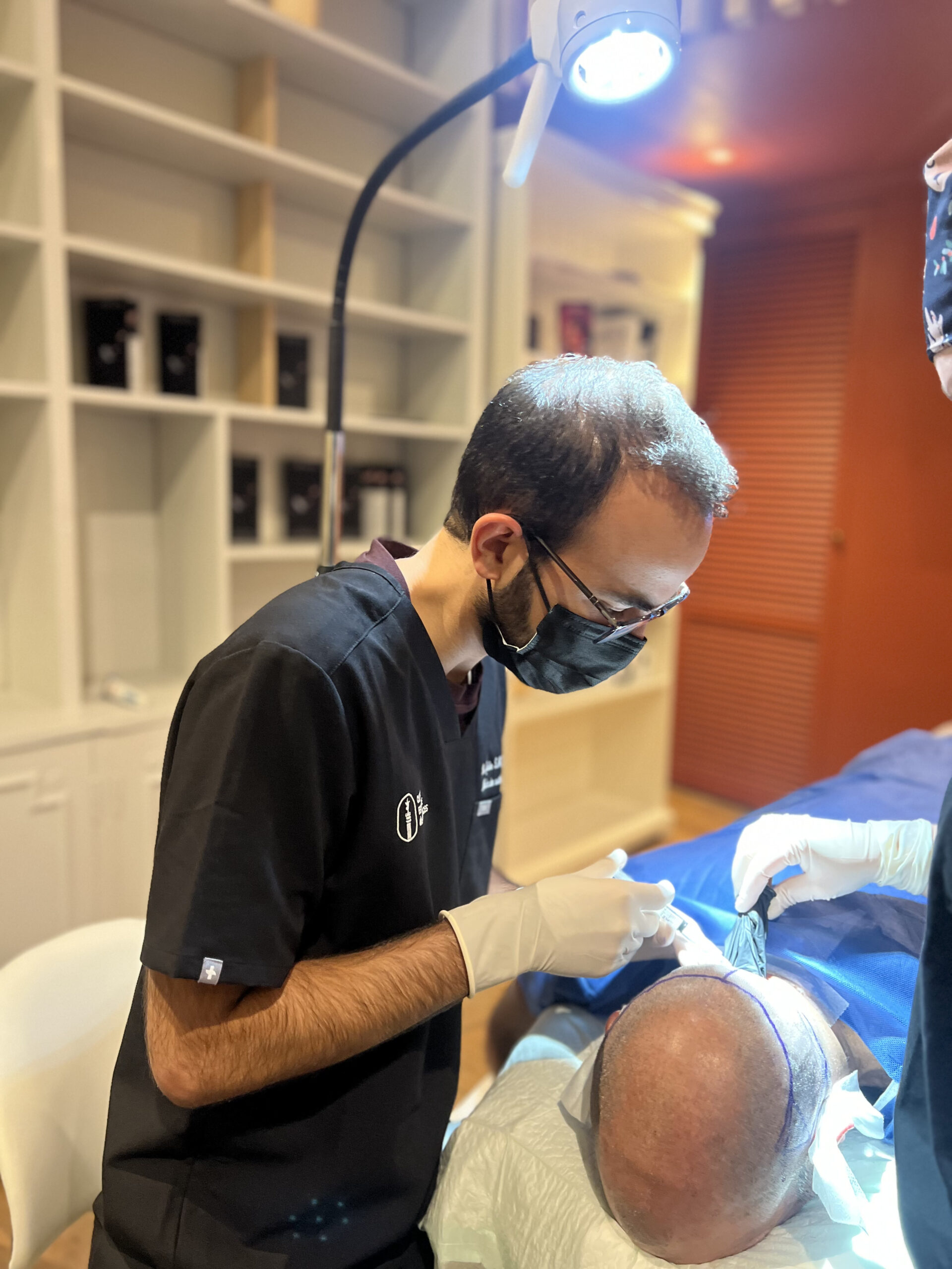 Greffe capillaire FUE réalisée à Bordeaux – implantation des greffons