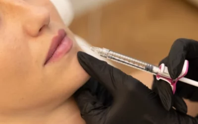 Injections d&rsquo;acide hyaluronique : zone du visage, durée, prix et résultats