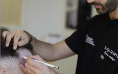 Golfes, ligne frontale ou tonsure : quelle stratégie de greffe selon la zone ?