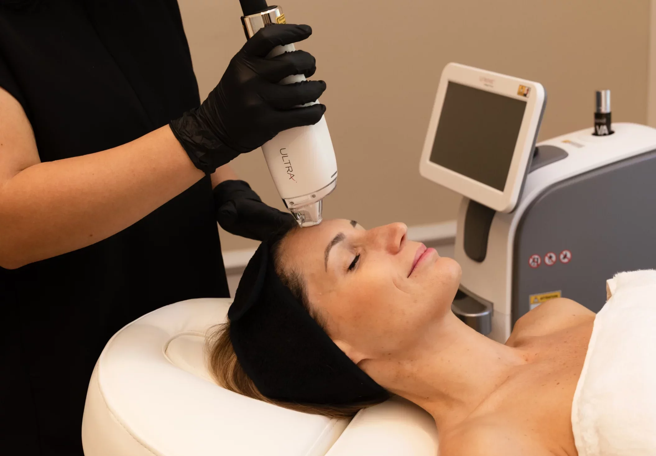 aser dermatologique du visage en médecine esthétique à Bordeaux
