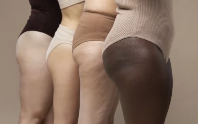 Cellulite à Bordeaux : quelles solutions pour réduire l’aspect peau d’orange ?